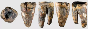 Neanderthal dentists used stone drills to fix ancient teeth